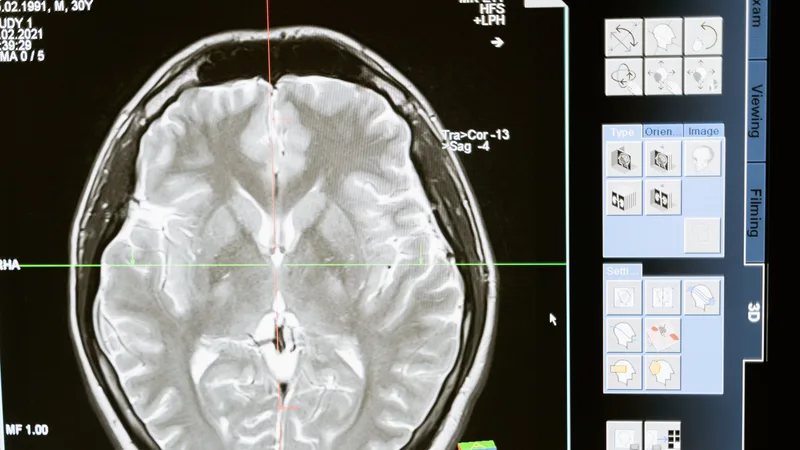 Intricate MRI brain scan displayed on a computer screen for medical analysis and diagnosis.